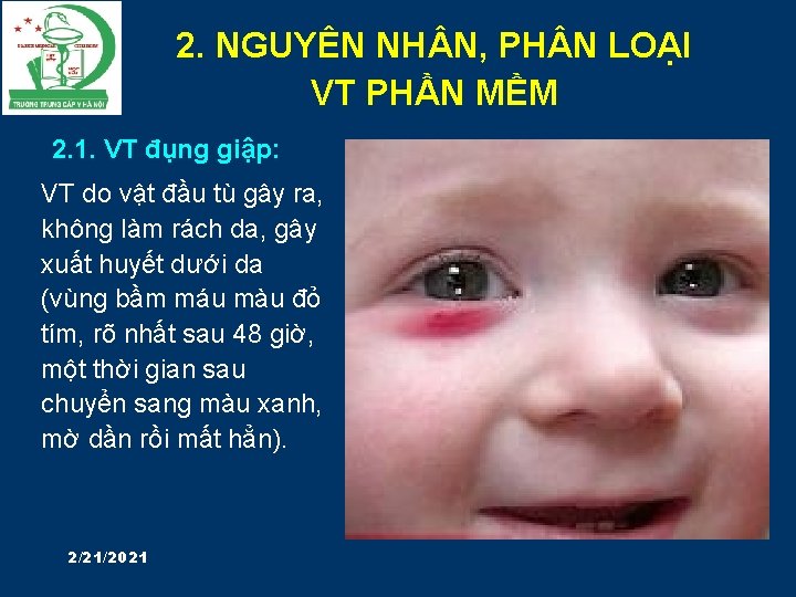 2. NGUYÊN NH N, PH N LOẠI VT PHẦN MỀM 2. 1. VT đụng