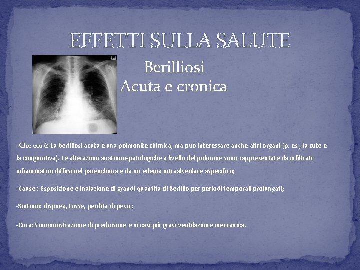 EFFETTI SULLA SALUTE Berilliosi Acuta e cronica -Che cos’è: La berilliosi acuta è una EFFETTI SULLA SALUTE Berilliosi Acuta e cronica -Che cos’è: La berilliosi acuta è una