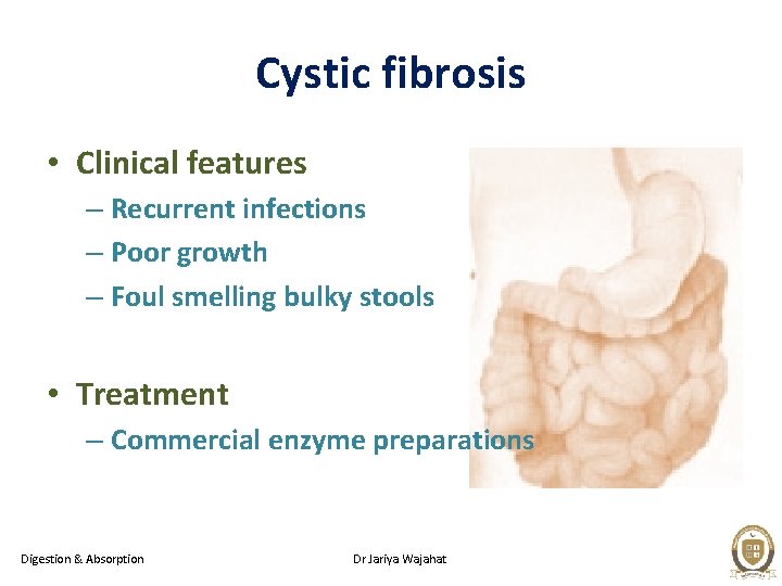 Cystic fibrosis • Clinical features – Recurrent infections – Poor growth – Foul smelling