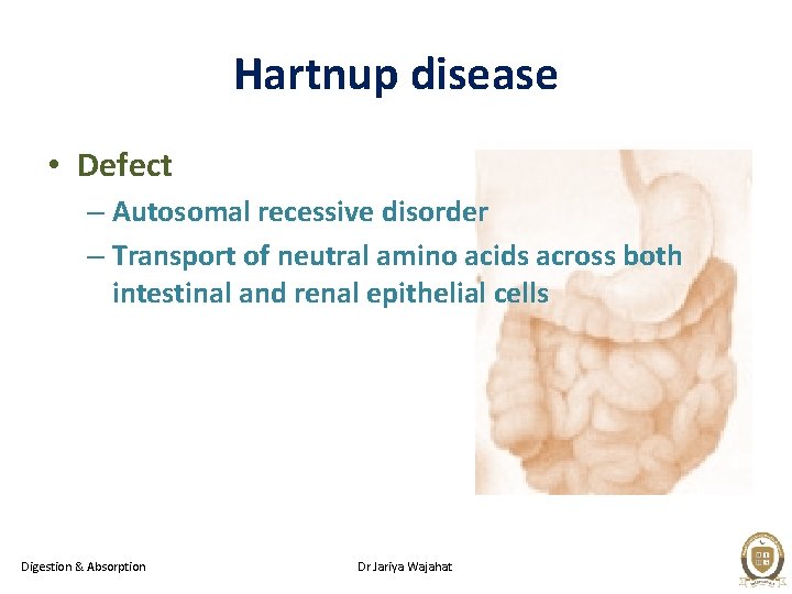 Hartnup disease • Defect – Autosomal recessive disorder – Transport of neutral amino acids