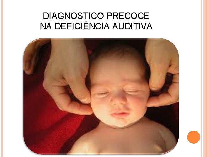 DIAGNÓSTICO PRECOCE NA DEFICIÊNCIA AUDITIVA 