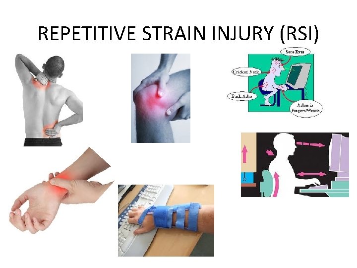 REPETITIVE STRAIN INJURY (RSI) 