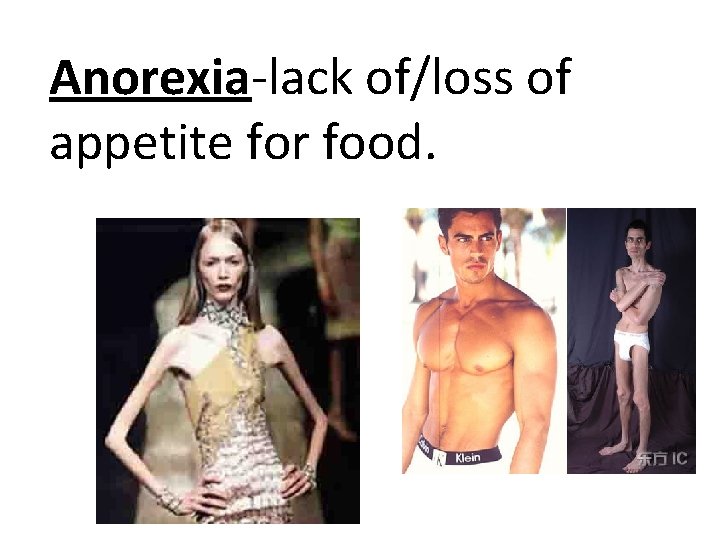 Anorexia-lack of/loss of appetite for food. 