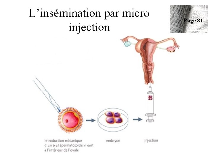 L’insémination par micro injection Page 81 