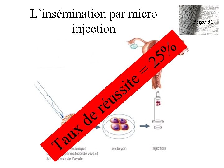 L’insémination par micro injection t i s = e a T x u e