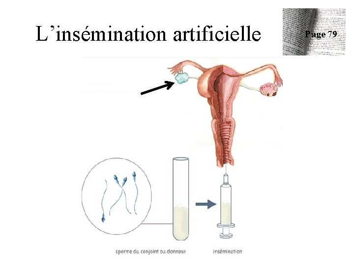 L’insémination artificielle Page 79 