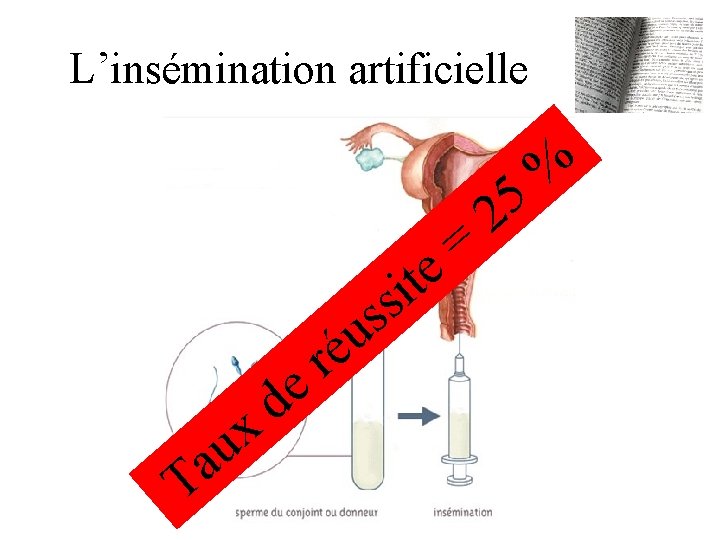 L’insémination artificielle = e t i s s u é r e u a L’insémination artificielle = e t i s s u é r e u a