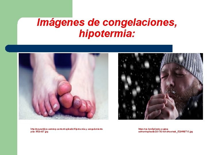 Imágenes de congelaciones, hipotermia: http: //soyoutdoor. com/wp-content/uploads/Hipotermia-y-congelamientopies-350 x 197. jpg https: //es. familydoctor. org/wpcontent/uploads/2017/01/shutterstock_529469713.