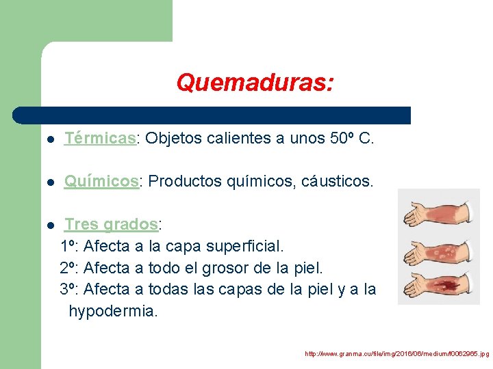 Quemaduras: l Térmicas: Objetos calientes a unos 50º C. l Químicos: Productos químicos, cáusticos.