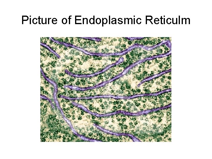 Picture of Endoplasmic Reticulm 