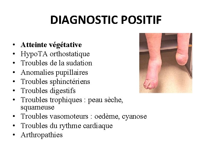 DIAGNOSTIC POSITIF • • Atteinte végétative Hypo. TA orthostatique Troubles de la sudation Anomalies