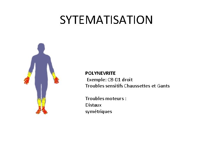 SYTEMATISATION POLYNEVRITE Exemple: C 8 -D 1 droit Troubles sensitifs Chaussettes et Gants Troubles