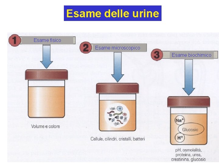 Esame delle urine Esame fisico Esame microscopico Esame biochimico 