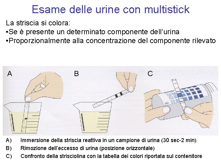 Esame delle urine con multistick La striscia si colora: • Se è presente un