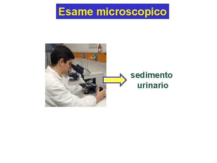 Esame microscopico sedimento urinario 