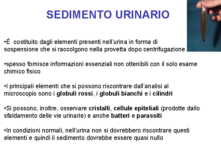 SEDIMENTO URINARIO • É costituito dagli elementi presenti nell’urina in forma di sospensione che