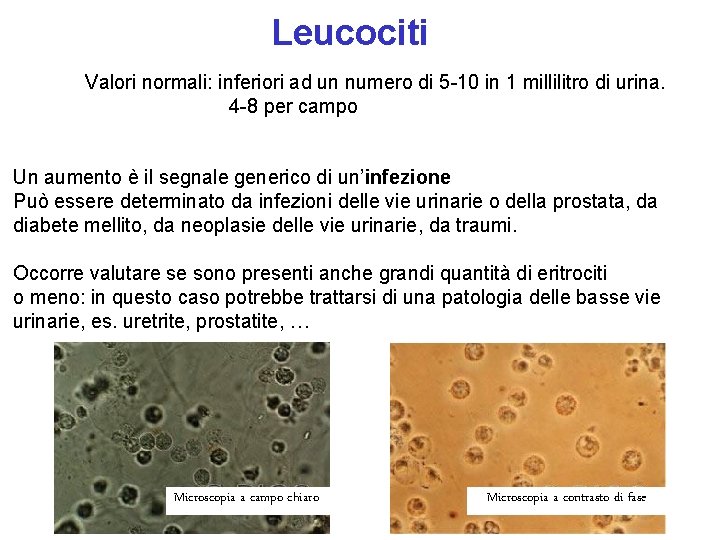 Leucociti Valori normali: inferiori ad un numero di 5 -10 in 1 millilitro di