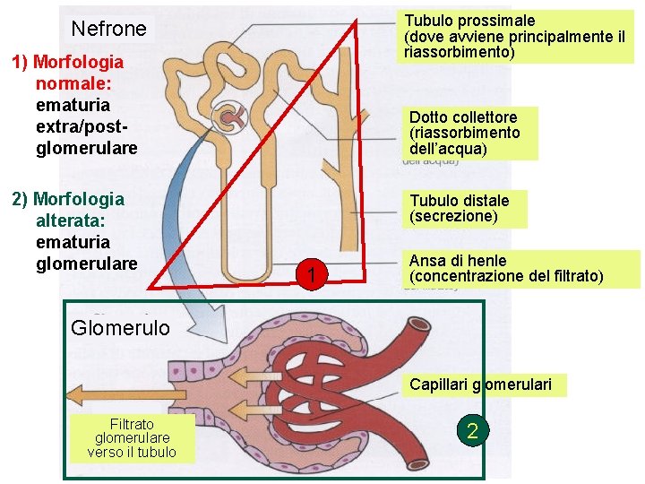 Tubulo prossimale (dove avviene principalmente il riassorbimento) Nefrone 1) Morfologia normale: ematuria extra/postglomerulare 2)