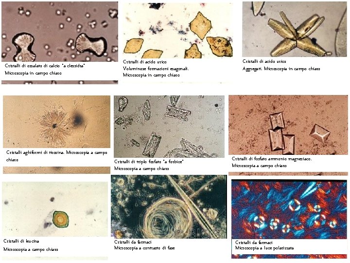 Cristalli di ossalato di calcio “a clessidra” Microscopia in campo chiaro Cristalli aghiformi di