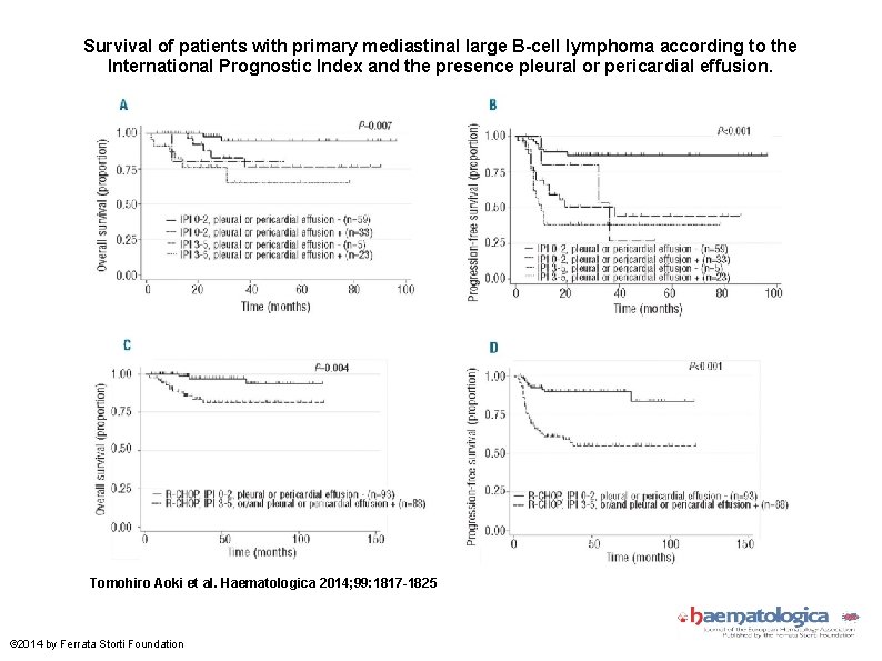 Survival of patients with primary mediastinal large B-cell lymphoma according to the International Prognostic