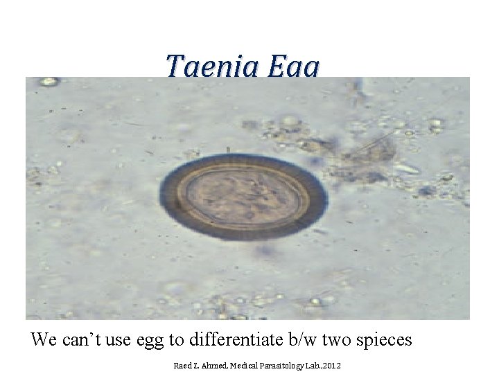 Taenia Egg We can’t use egg to differentiate b/w two spieces Raed Z. Ahmed,