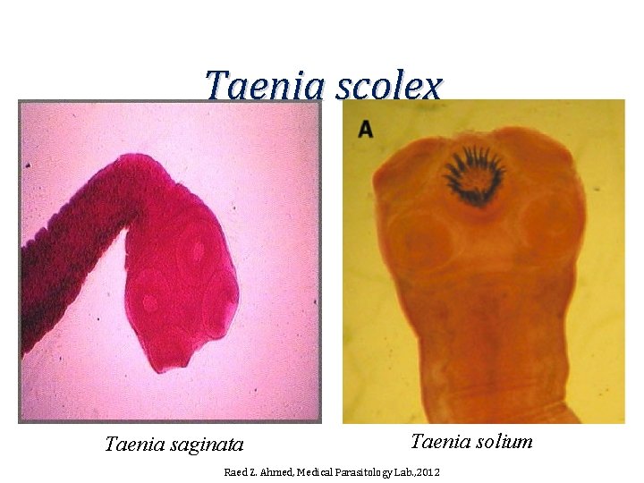 Taenia scolex Taenia saginata Taenia solium Raed Z. Ahmed, Medical Parasitology Lab. , 2012