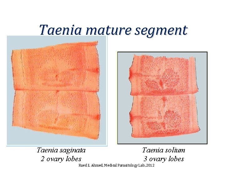 Taenia mature segment Taenia saginata 2 ovary lobes Taenia solium 3 ovary lobes Raed