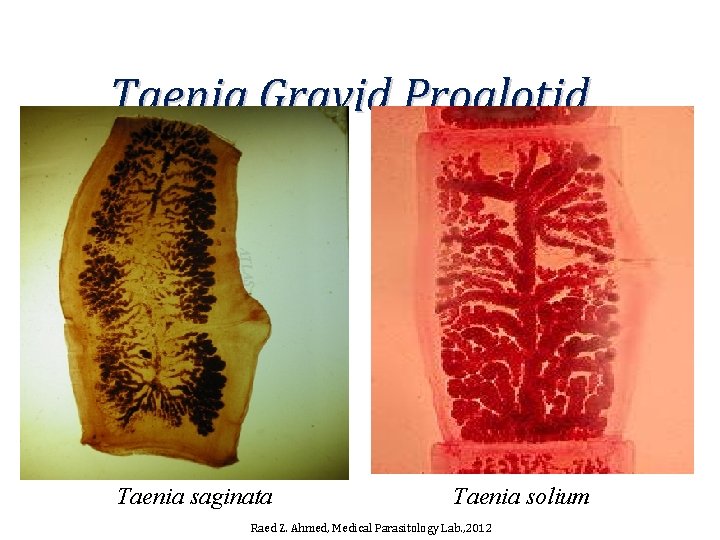 Taenia Gravid Proglotid Taenia saginata Taenia solium Raed Z. Ahmed, Medical Parasitology Lab. ,