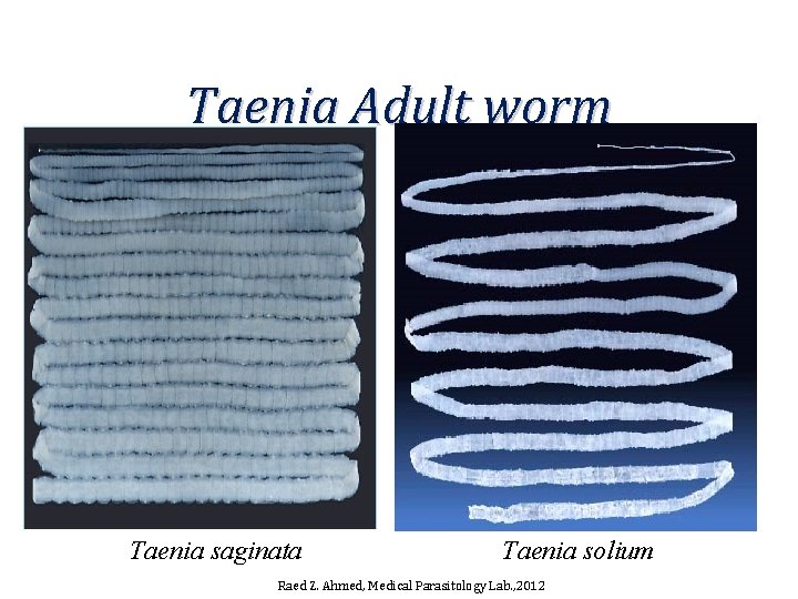 Taenia Adult worm Taenia saginata Taenia solium Raed Z. Ahmed, Medical Parasitology Lab. ,