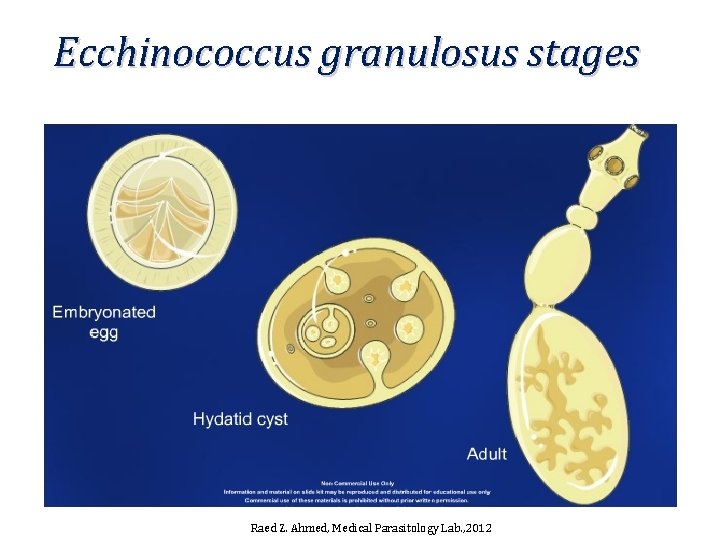 Ecchinococcus granulosus stages Raed Z. Ahmed, Medical Parasitology Lab. , 2012 
