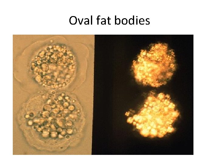 Oval fat bodies 