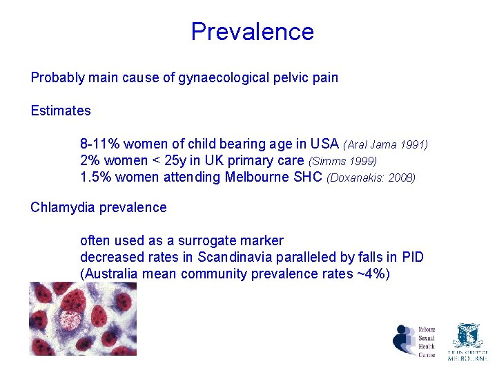 Prevalence Probably main cause of gynaecological pelvic pain Estimates 8 -11% women of child Prevalence Probably main cause of gynaecological pelvic pain Estimates 8 -11% women of child