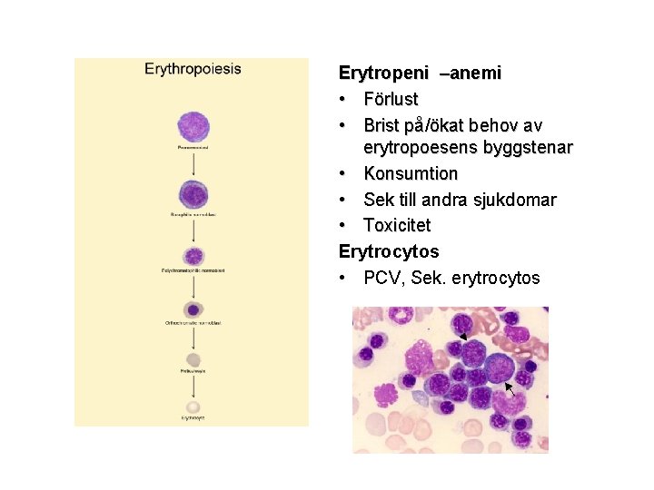 Erytropeni –anemi • Förlust • Brist på/ökat behov av erytropoesens byggstenar • Konsumtion •