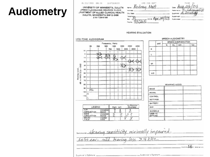 Audiometry 16 