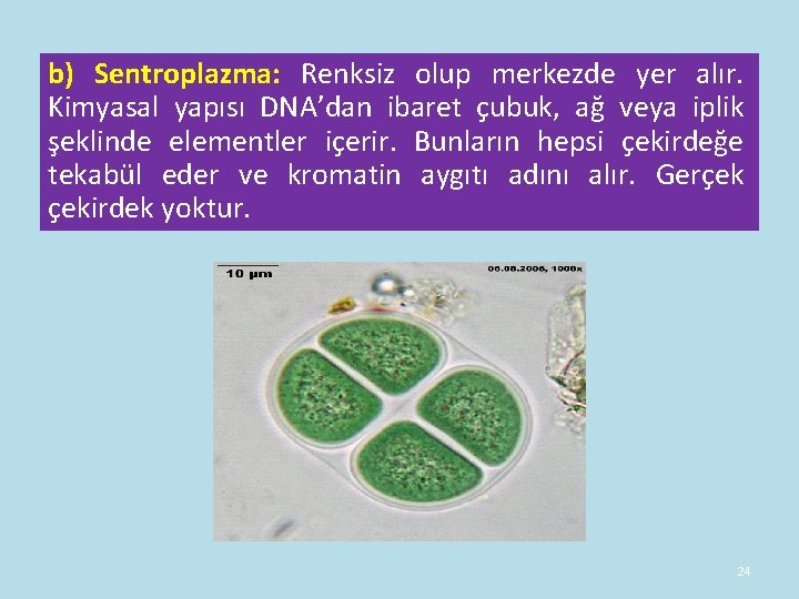 b) Sentroplazma: Renksiz olup merkezde yer alır. Kimyasal yapısı DNA’dan ibaret çubuk, ağ veya b) Sentroplazma: Renksiz olup merkezde yer alır. Kimyasal yapısı DNA’dan ibaret çubuk, ağ veya