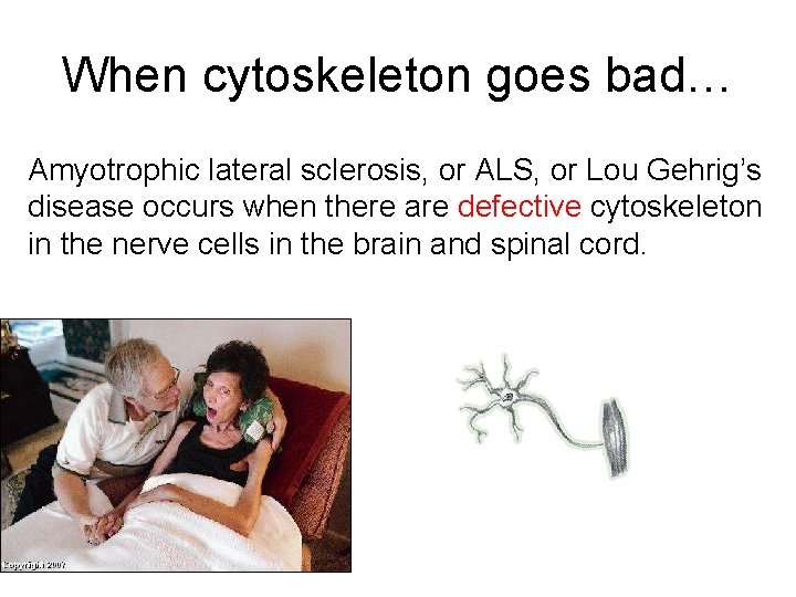 When cytoskeleton goes bad… Amyotrophic lateral sclerosis, or ALS, or Lou Gehrig’s disease occurs