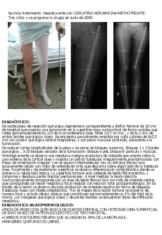 Se inicia tratamiento neoadyuvante con CISPLATINO-ADRIAMICINA-METHOTREXATE. Tres ciclos y se programa la cirugía en