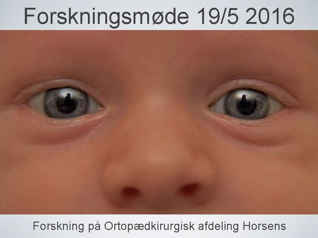 Forskningsmøde 19/5 2016 Forskning på Ortopædkirurgisk afdeling Horsens 