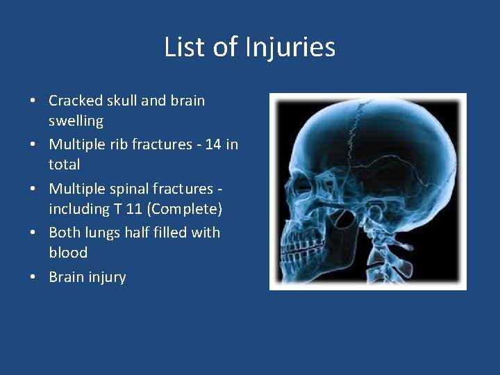 List of Injuries • Cracked skull and brain swelling • Multiple rib fractures -