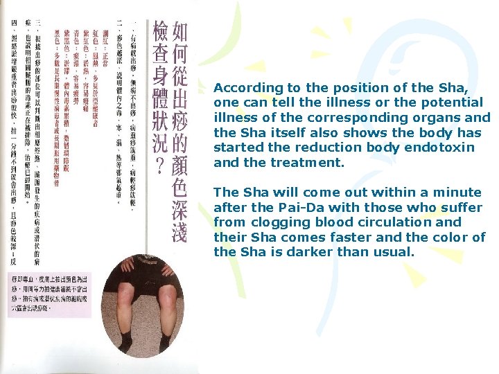 According to the position of the Sha, one can tell the illness or the