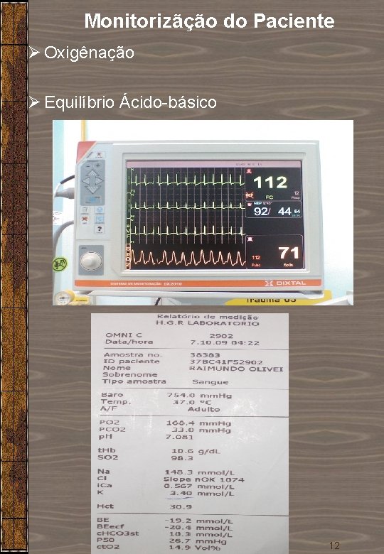 Monitorizãção do Paciente Ø Oxigênação Ø Equilíbrio Ácido-básico 12 Monitorizãção do Paciente Ø Oxigênação Ø Equilíbrio Ácido-básico 12