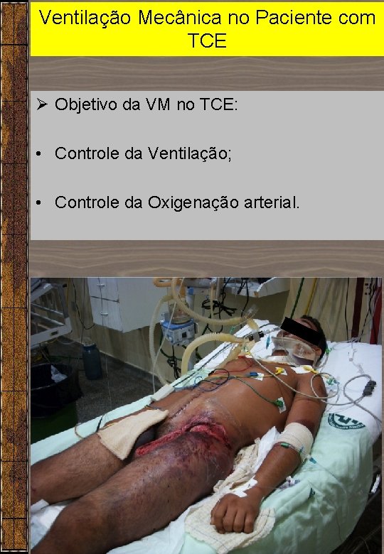Ventilação Mecânica no Paciente com TCE Ø Objetivo da VM no TCE: • Controle Ventilação Mecânica no Paciente com TCE Ø Objetivo da VM no TCE: • Controle