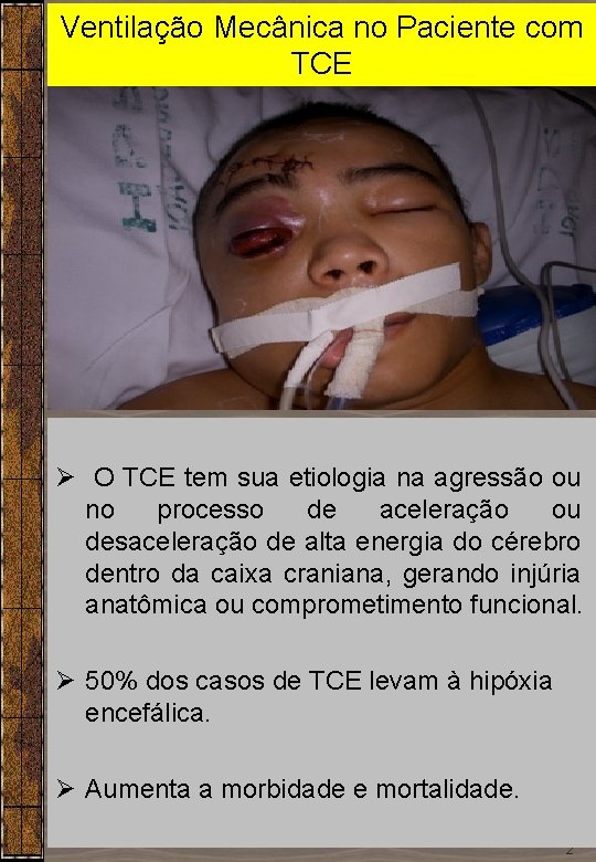 Ventilação Mecânica no Paciente com TCE Dr. Sérgio Cruz Ø O TCE tem sua Ventilação Mecânica no Paciente com TCE Dr. Sérgio Cruz Ø O TCE tem sua