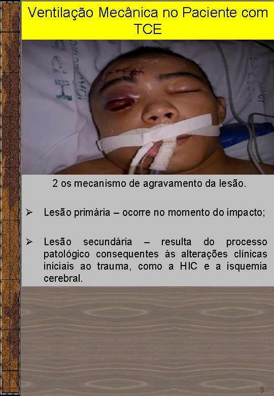 Ventilação Mecânica no Paciente com TCE Dr. Sérgio Cruz 2 os mecanismo de agravamento Ventilação Mecânica no Paciente com TCE Dr. Sérgio Cruz 2 os mecanismo de agravamento