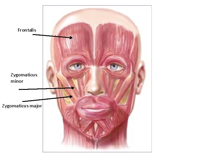 Frontalis Zygomaticus minor Zygomaticus major 