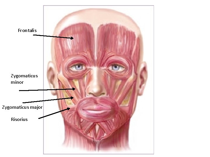 Frontalis Zygomaticus minor Zygomaticus major Risorius 