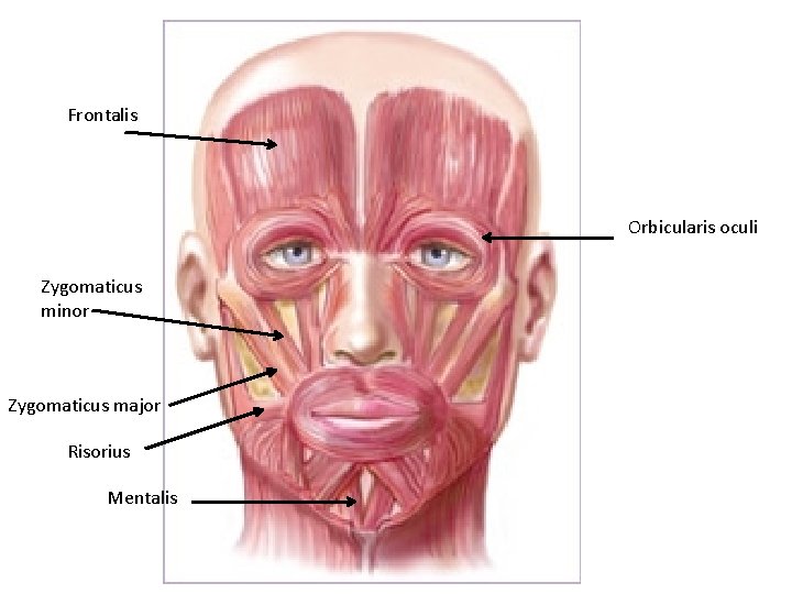 Frontalis Orbicularis oculi Zygomaticus minor Zygomaticus major Risorius Mentalis 