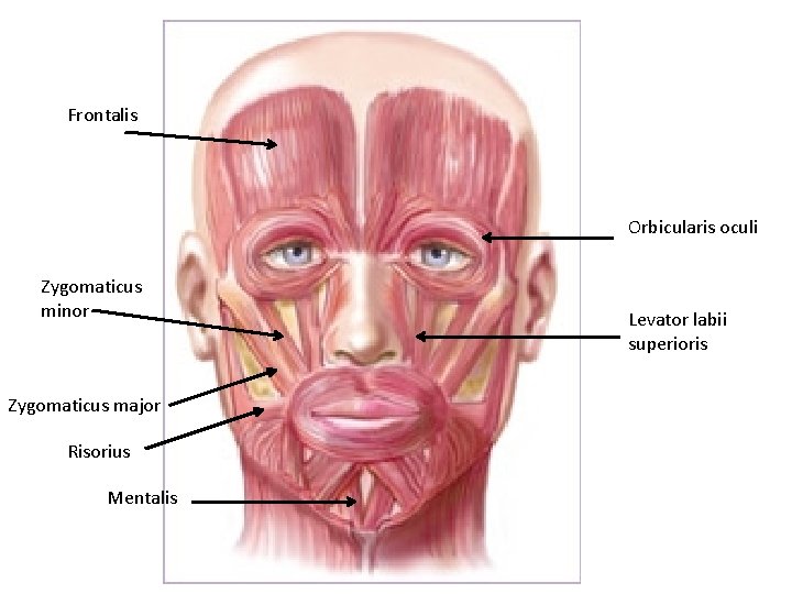 Frontalis Orbicularis oculi Zygomaticus minor Zygomaticus major Risorius Mentalis Levator labii superioris 