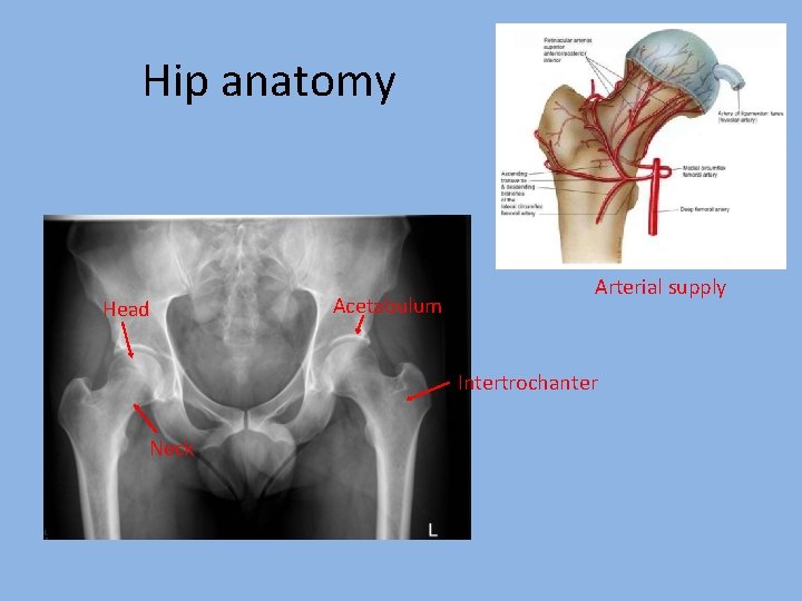 Hip anatomy Head Acetabulum Arterial supply Intertrochanter Neck 