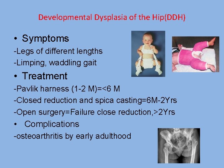 Developmental Dysplasia of the Hip(DDH) • Symptoms -Legs of different lengths -Limping, waddling gait
